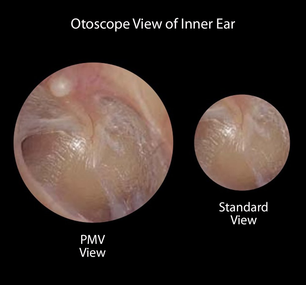 ADC Diagnostix™ 3.5v Portable Instruments- PMV and Standard Otoscope, Single Instrument In Soft Case