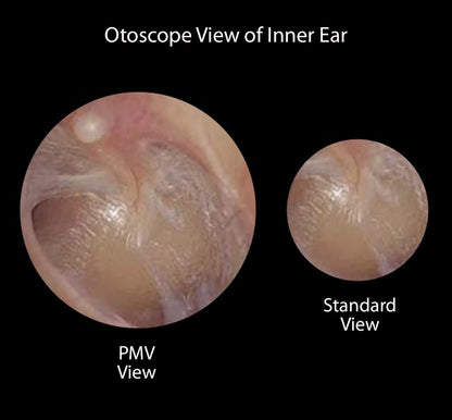 ADC Diagnostix™ 3.5v Portable Instruments- PMV and Standard Otoscope, Single Instrument In Soft Case