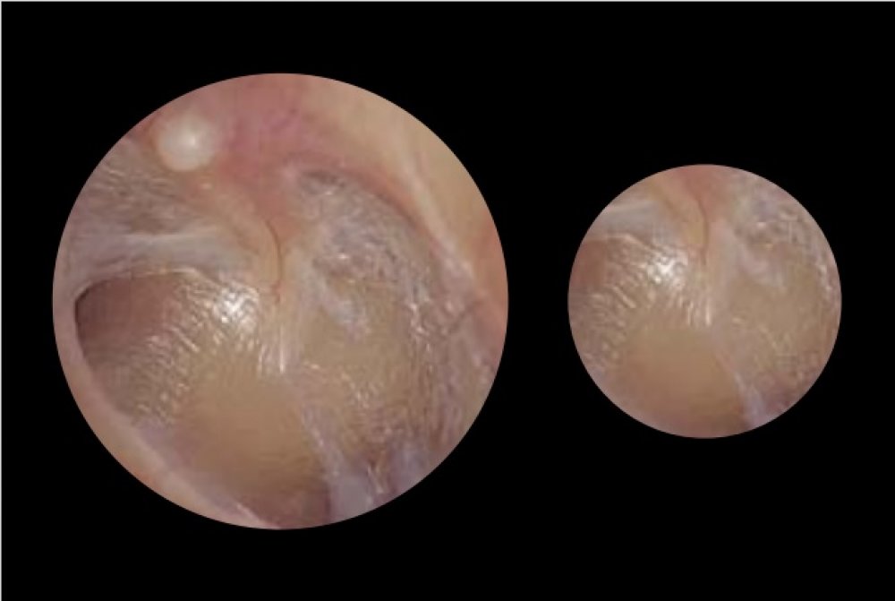 ADC Adstation™ 5680-38W- 3.5V Modular Diagnostix Wall System with e-sphyg 3, PMV Otoscope, Coax+ Ophth, Dispenser, Thermometer, W.Board